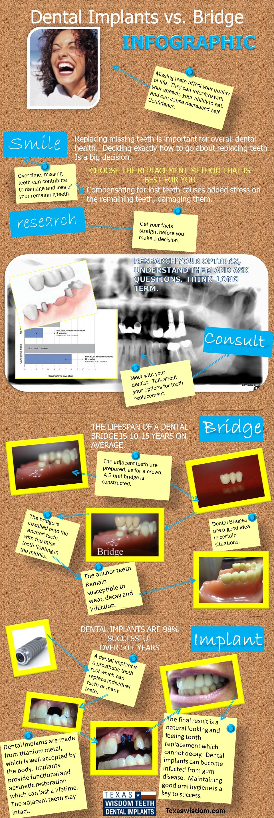 Dental Implant vs. Bridge